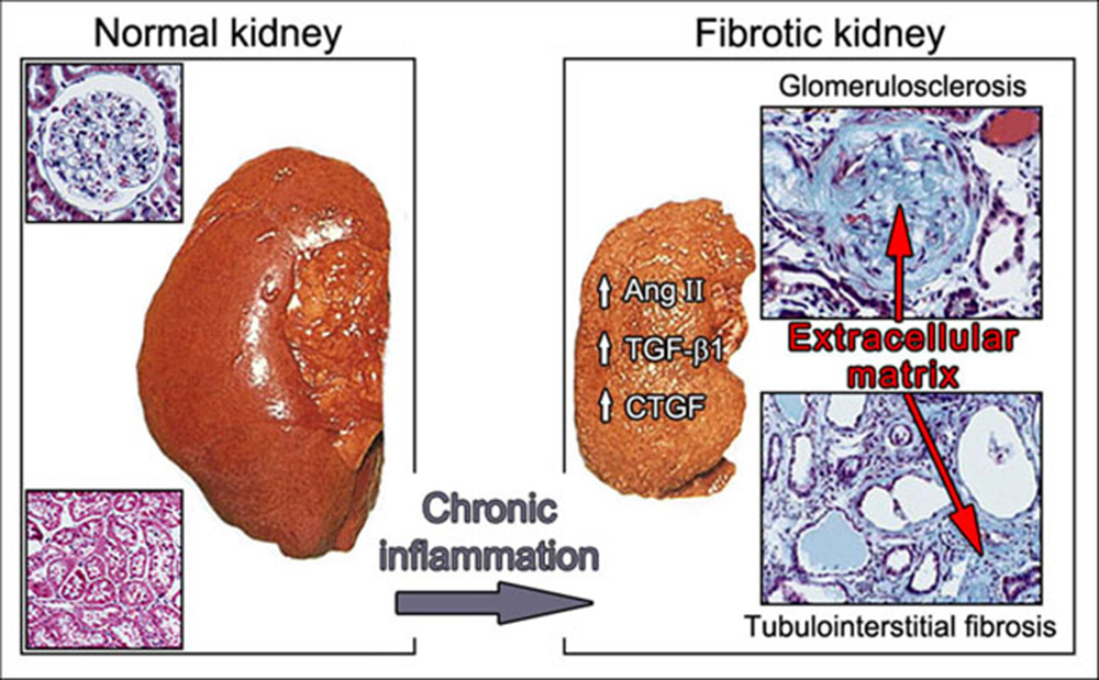 fig-2